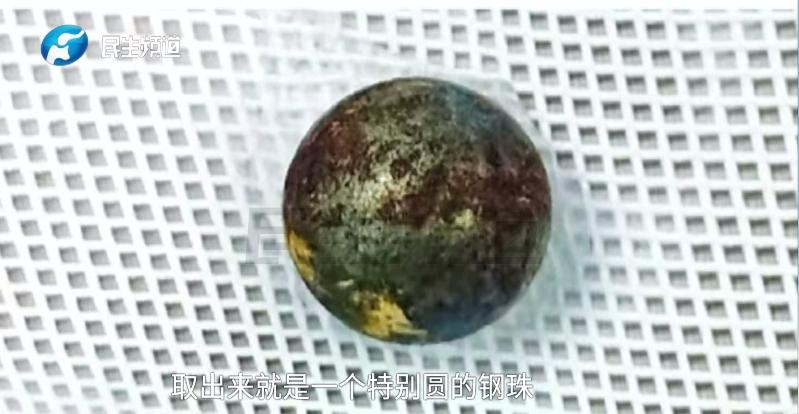 面部磁力吸铁石_生活中磁铁的应用视频_颌面钢珠异物取出