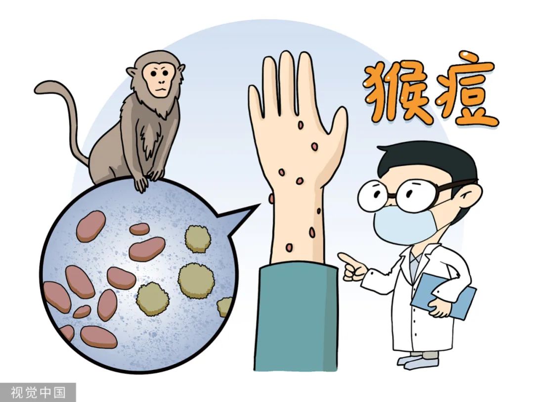 猴痘、天花、牛痘、水痘怎么应对？