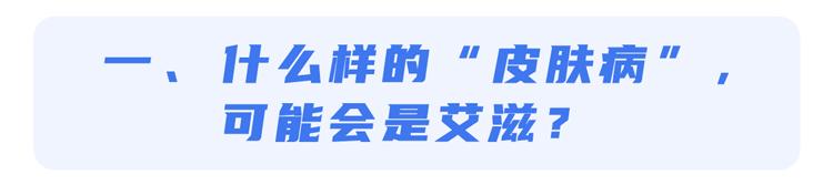 艾滋病皮疹特点_艾滋病皮肤症状_艾滋病 长痘